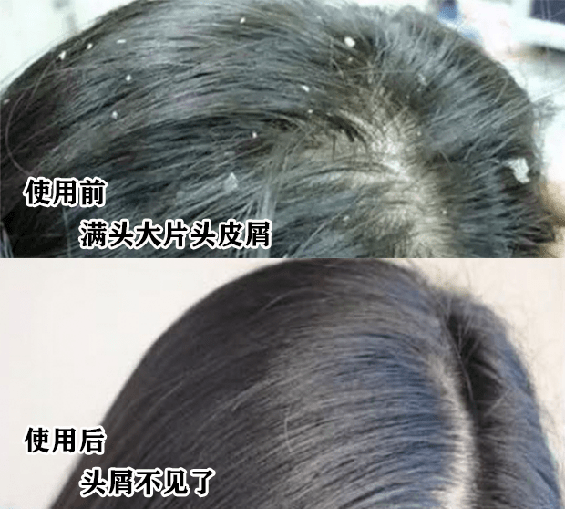 洗头“你的头发影响了你80%的颜值”：康王创始人87岁再出山，挑战5天不洗头！