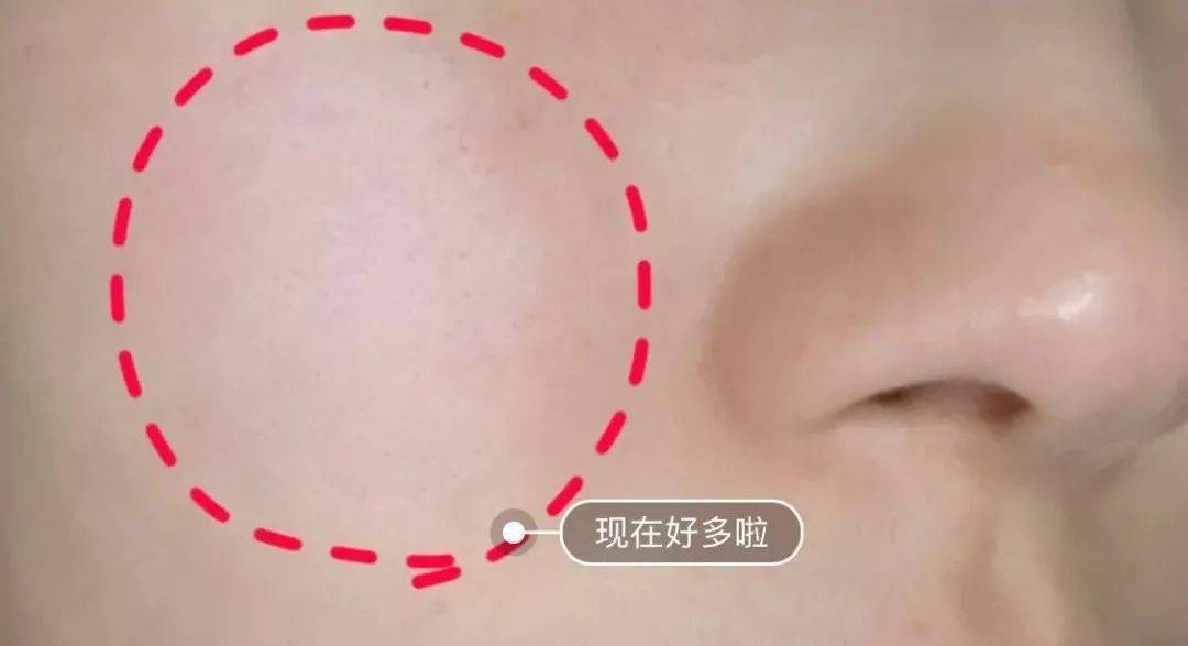 优惠新年捡漏：兰蔻小黑瓶直降1000！抱歉，这么大优惠说晚了...
