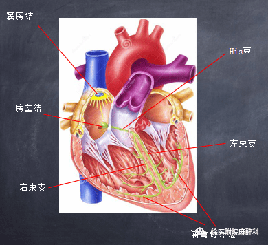 专题 | 预激综合征的麻醉管理(徐医附院麻醉科)_心电图_旁路_窦性