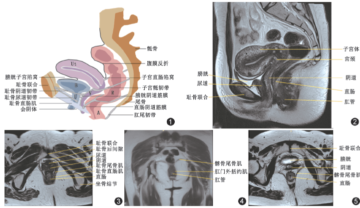 女性盆底功能障碍性疾病的mri技术与报告规范