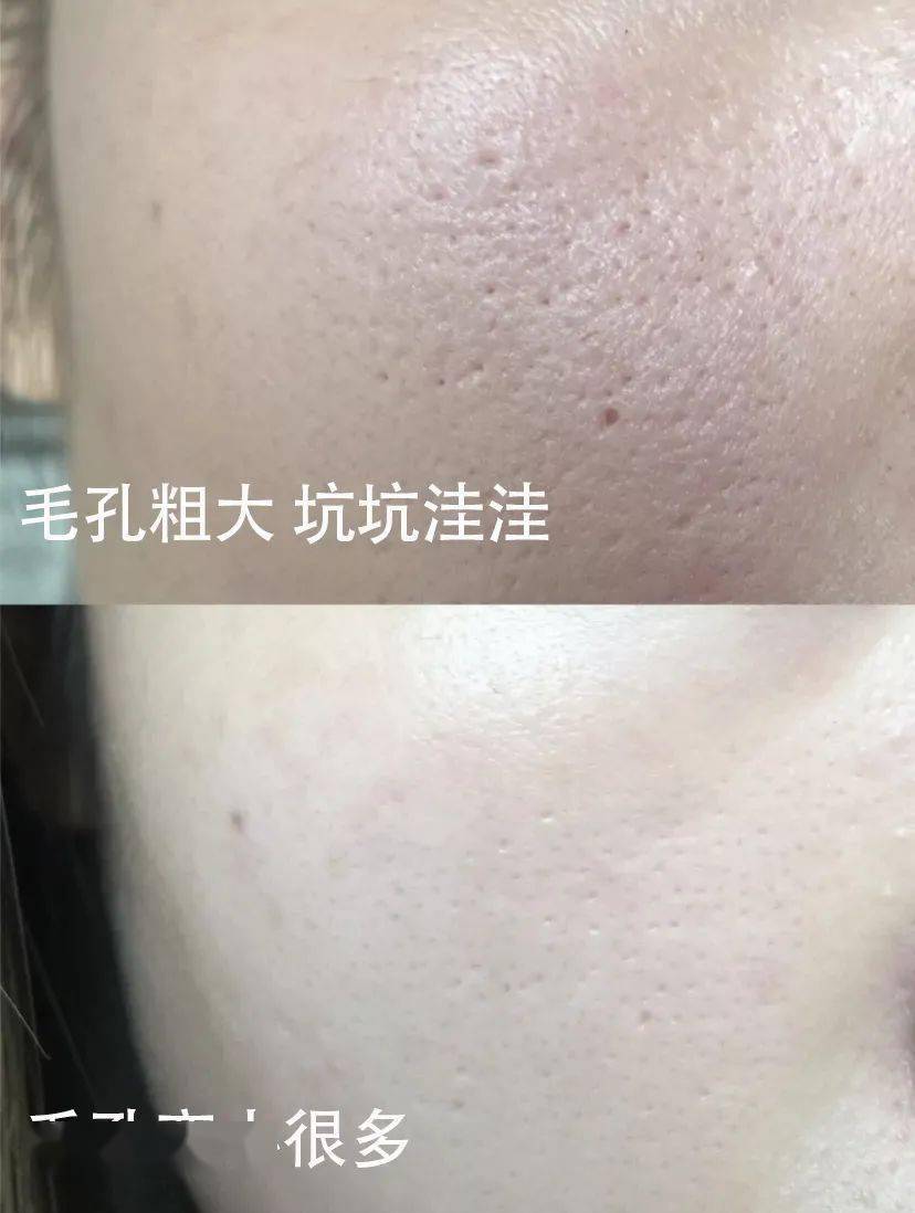 品牌立省近500!抢雪花秀“零差评”水乳6件套,补水滋润,提亮肤色