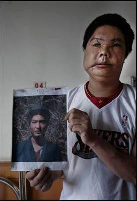 一个黑影跳了出来,李国兴看清是黑熊的时候已经晚了,整张脸惨遭毁容