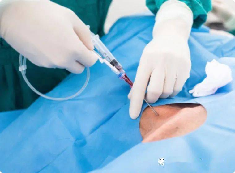 患者安全 | 静脉导管位置隐蔽所致危险_麻醉_手术_液体