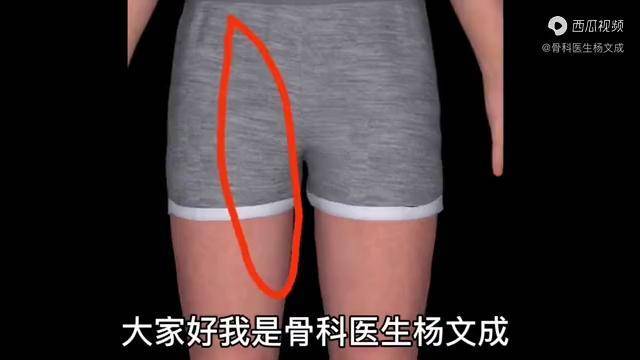 大腿根部疼痛大腿内侧疼痛麻木这种情况你有过吗