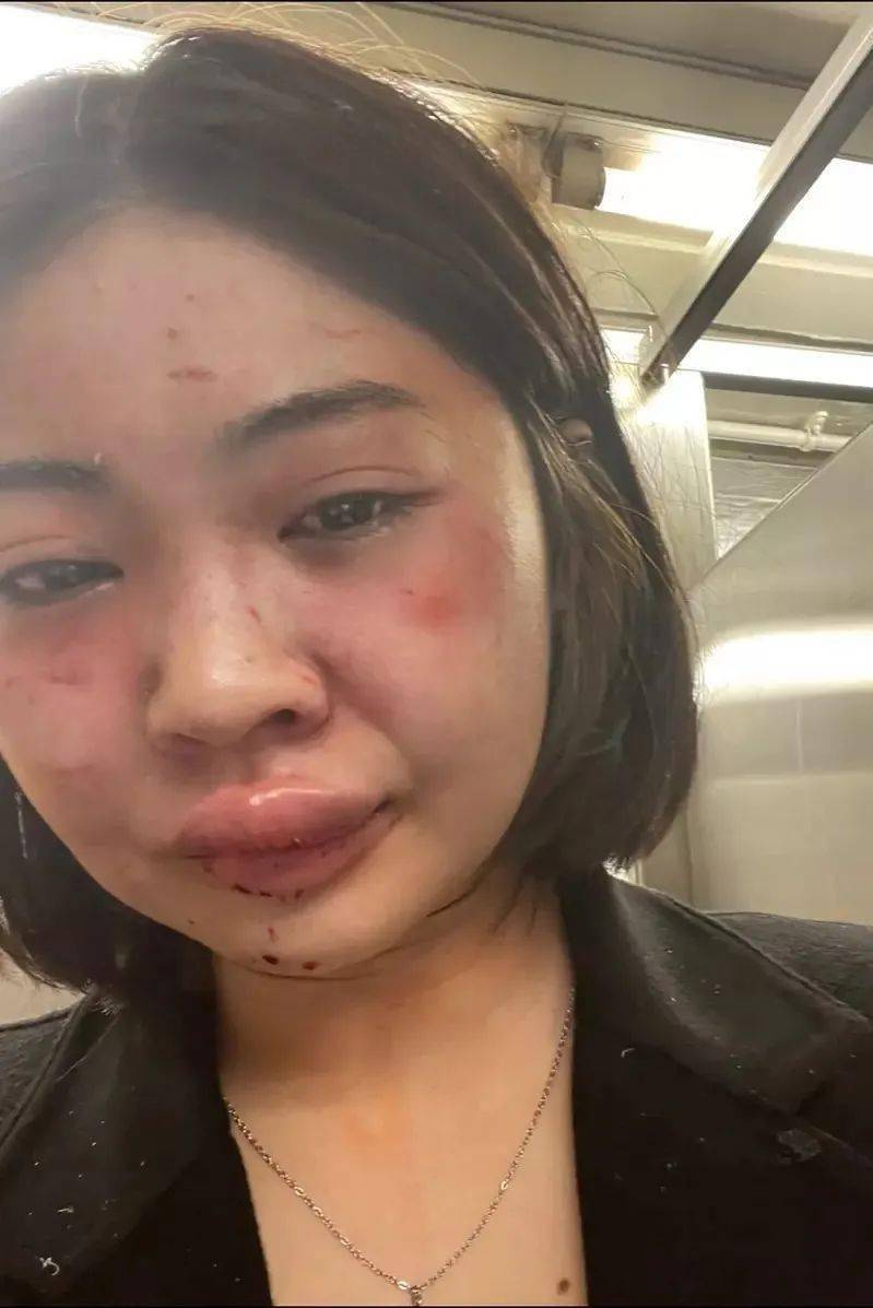 曼哈顿殴打泰国美女模特的嫌犯曾1天被捕16次