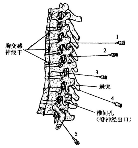 胸交感神经节星状神经节接受来自t1(有的也包括t2)的白交通支,星状