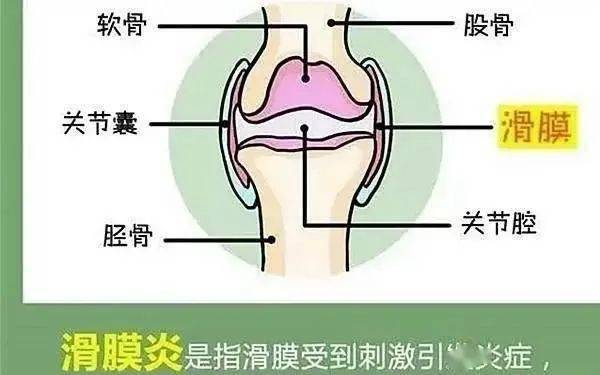 膝关节积液治疗方法图片