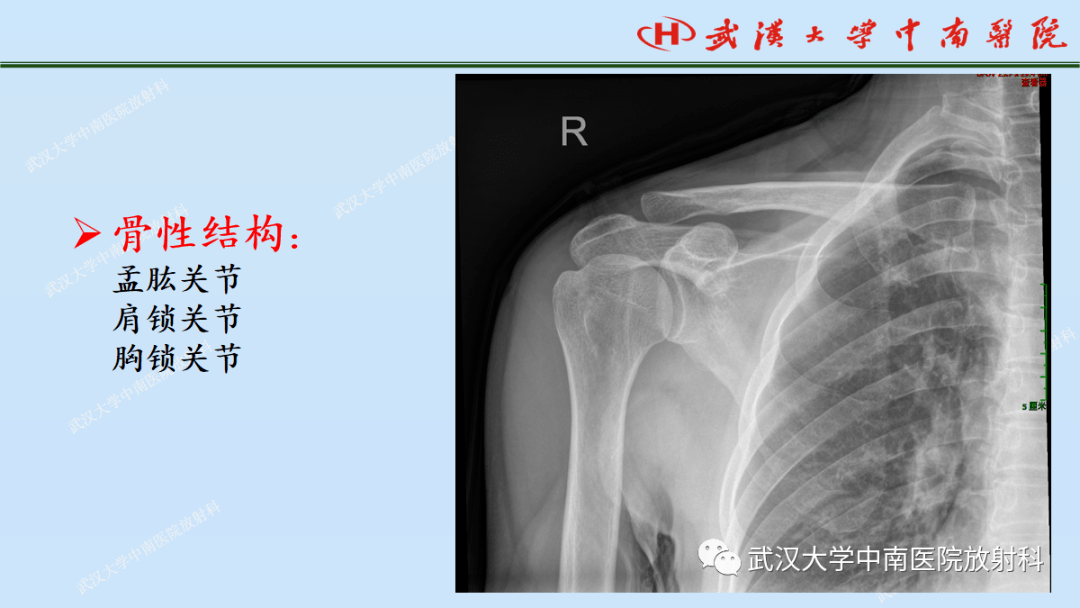 肩关节x线解剖图片