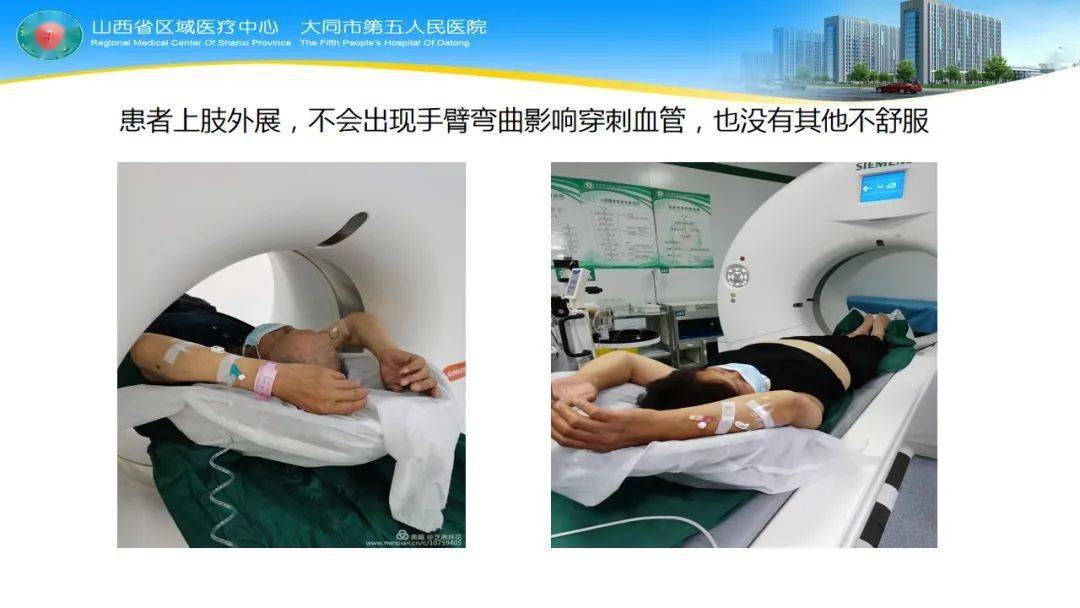 血管条件差ct增强静脉留置针可以这样做