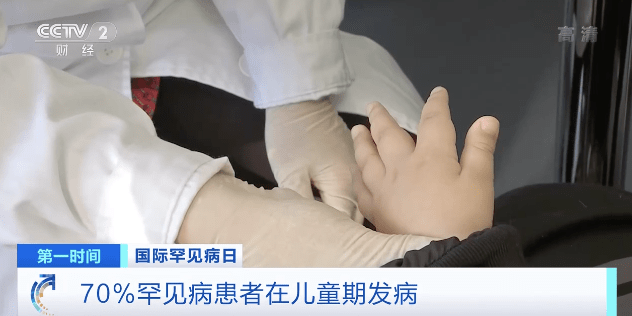 国家儿童医学中心 北京儿童医院神经内科主任医师 吕俊兰:罕见病的