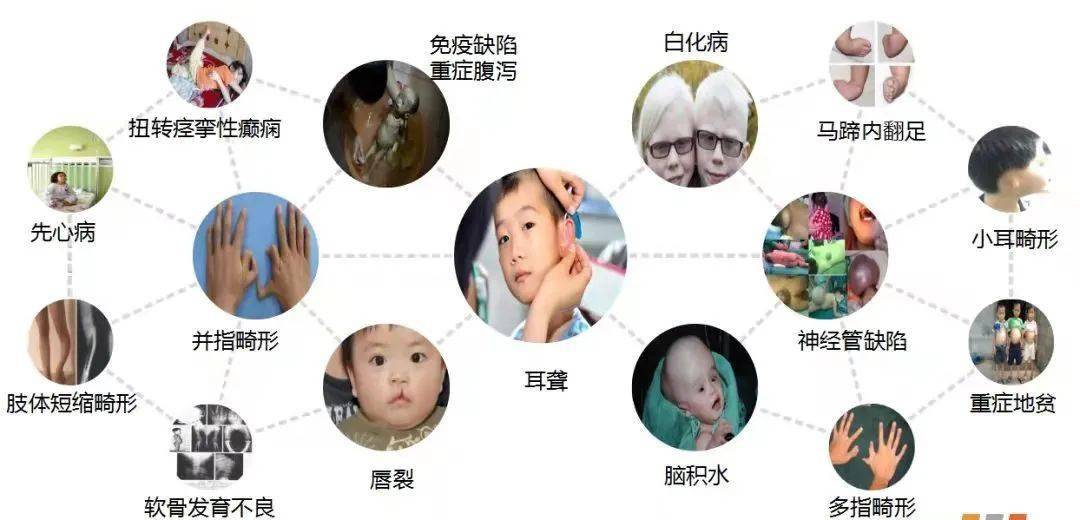 国际罕见病日关于罕见病你了解多少