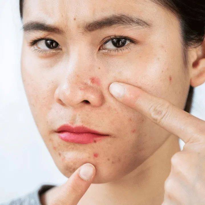 “慢性毁容”?八个日常习惯让你越变越丑,来看看你有吗?_皮肤_眼睛_身体