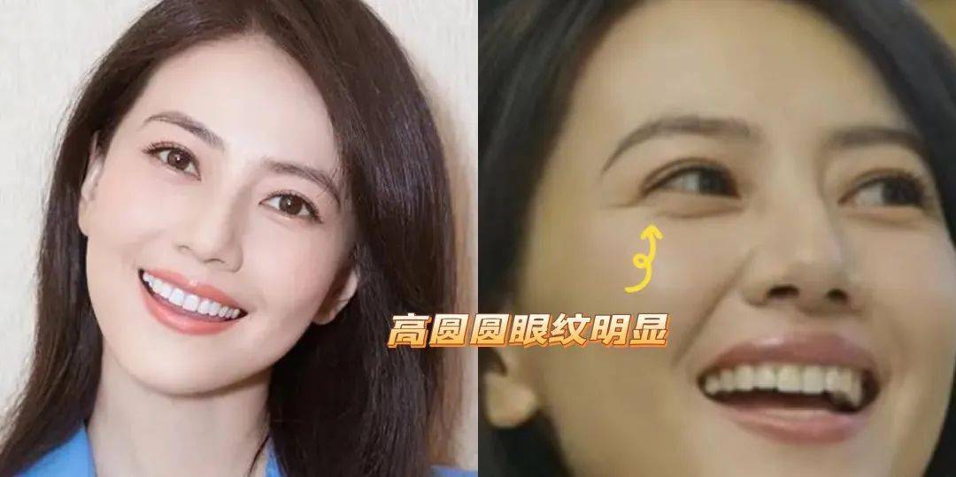 贵妇她眼睛怎么这样？娜B才20岁啊，这也太冤了吧…