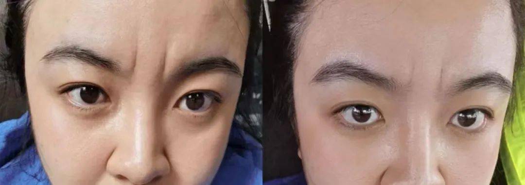 内部测试她眼睛怎么这样？娜B才20岁啊，这也太冤了吧…