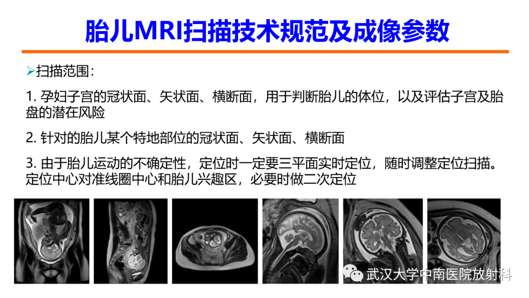 胎兒mri中國專家共識解讀_全網_影像_解剖圖