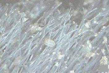 头皮头屑暴增？头皮扣下“白泥”？用Ta,帮你揪出头屑“内鬼”！清爽柔顺，发量翻一番！