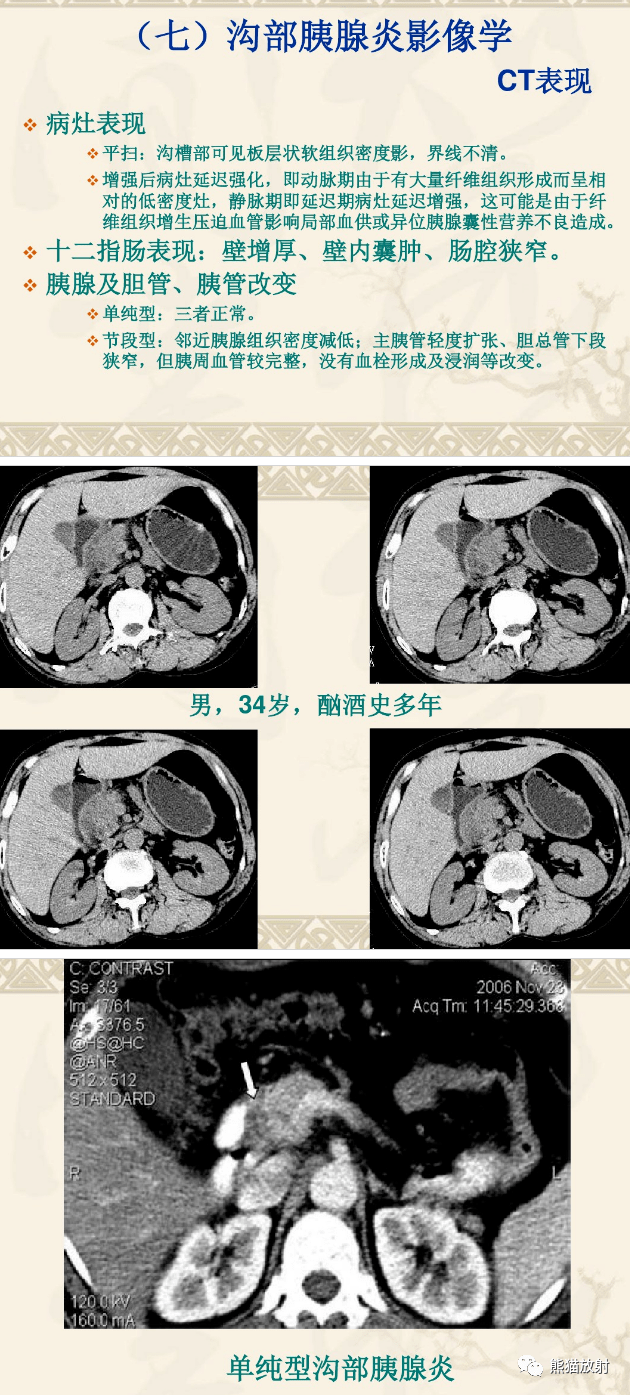 实质|临床及影像表现