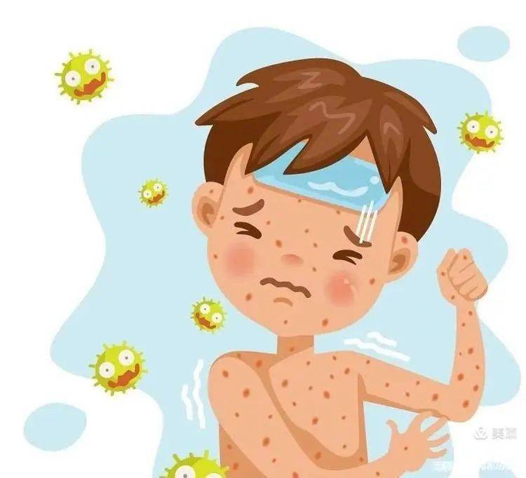 麻疹进入春季高发期 阜平疾控中心提醒家长:适龄儿童务必及时接种疫苗