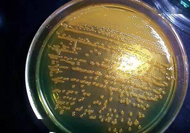 池塘底部一些饲料,残饵和死藻上附着大量的副溶血弧菌,哈维氏弧菌