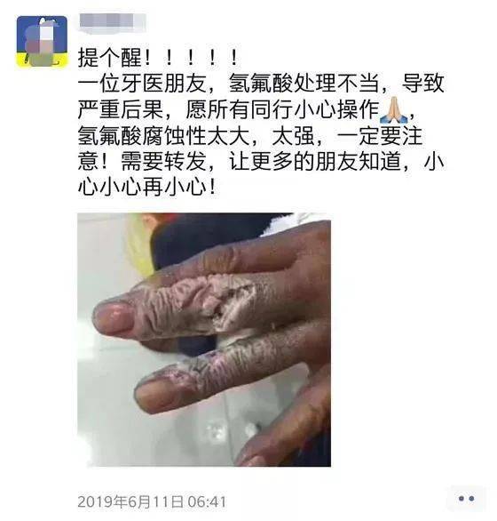 氢氟酸到底有多恐怖看完你绝对不想触碰