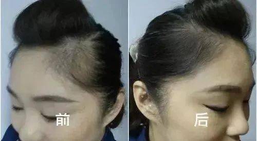 发型DOUBLE UP蓬蓬美发粉饼！防水防汗不易脱！让你瞬间年轻十岁！