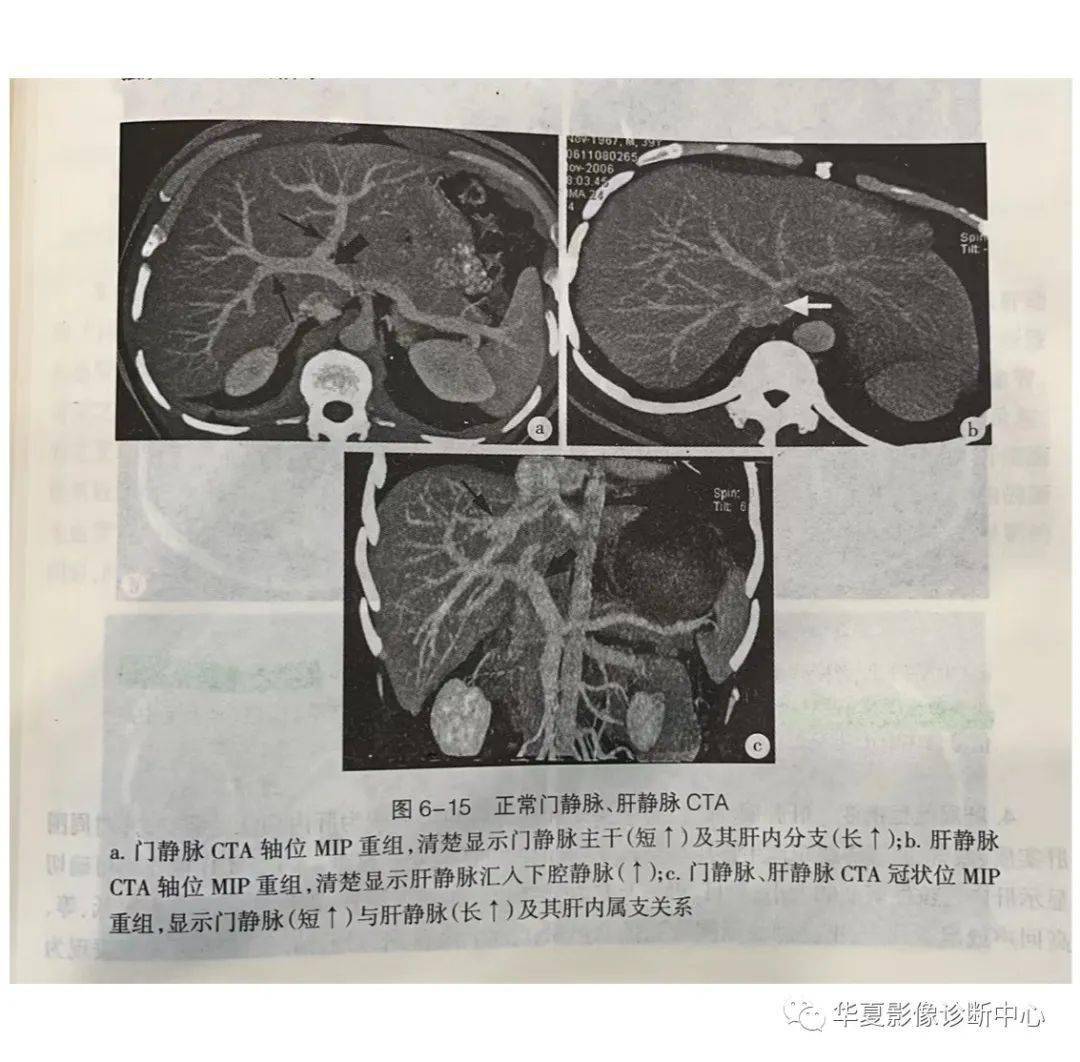 解剖|肝脏影像学与系统解剖