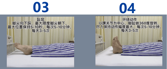 踝泵运动:关注"浙江省人民医院泌尿外科"公众号,搜索"盆底肌锻炼"