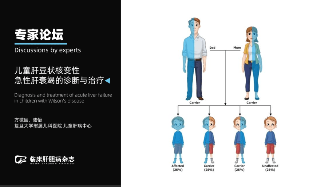 专家论坛|陆怡:儿童肝豆状核变性急性肝衰竭的诊断与治疗_tbil_肝脏