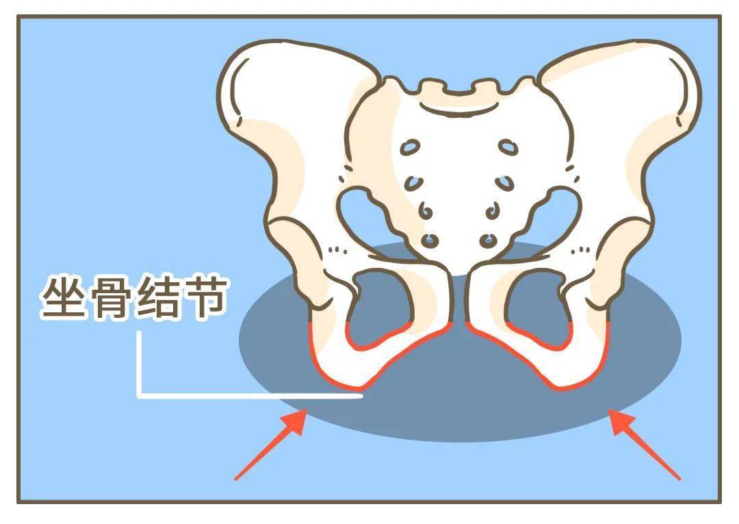 盆腔结节图片