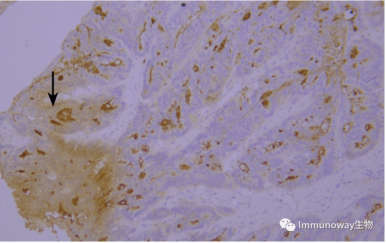 免疫组化(ihc)│常见问题及解析集锦_组织_染色_抗原