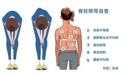 健康丨患者超过500万被忽视的中小学生脊柱侧弯