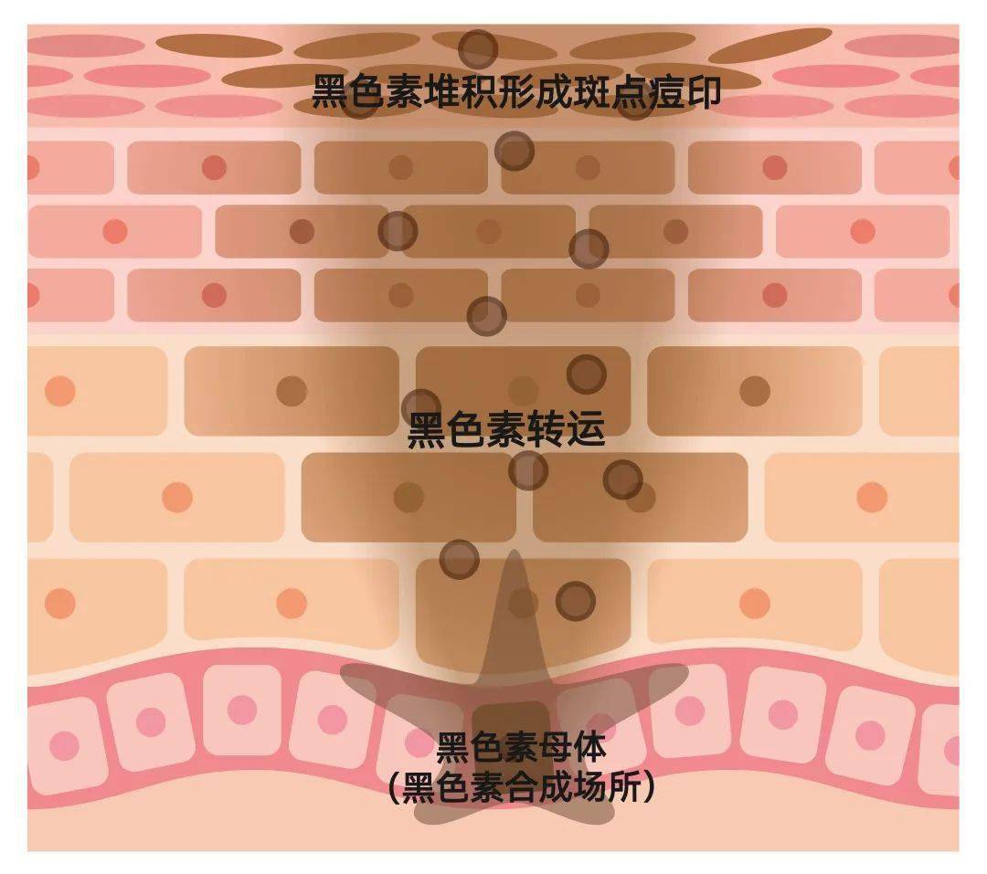降低其活跃性,减少色素的扩散和沉积,其次可以抑制伸出,根源减少斑点