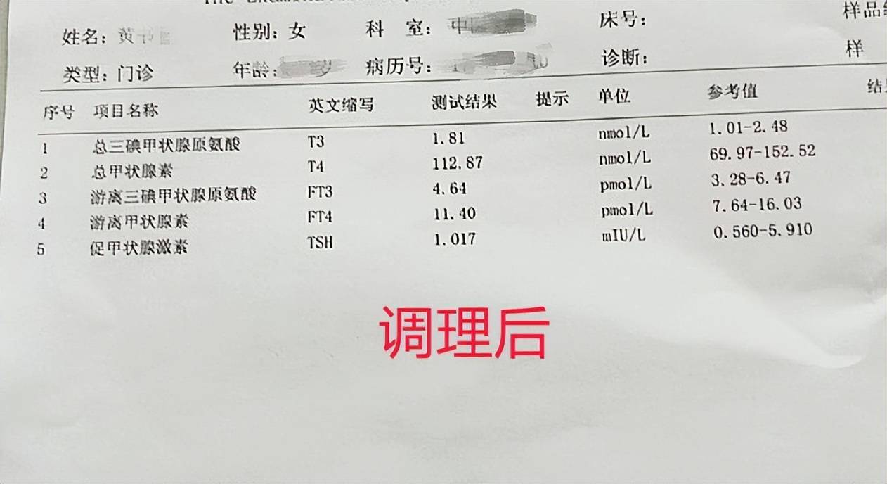 甲亢检查报告单图片图片