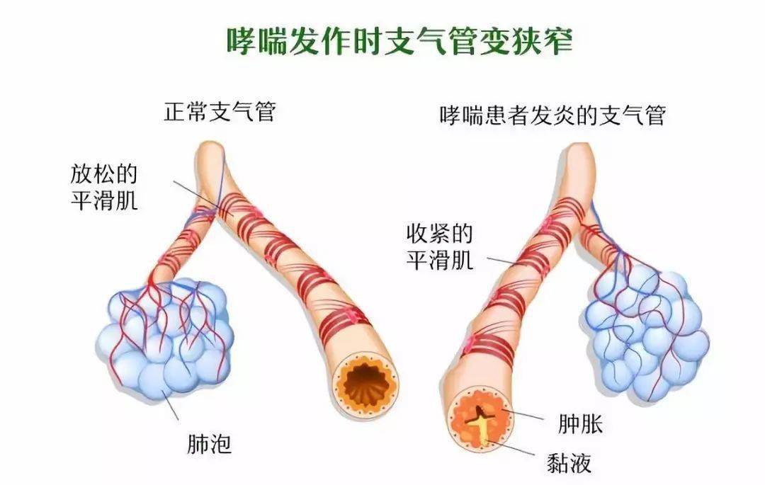 呼吸性细支气管图片图片