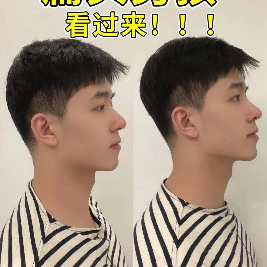 男生发型|不做扁头男孩!_加糖_奶茶_于小