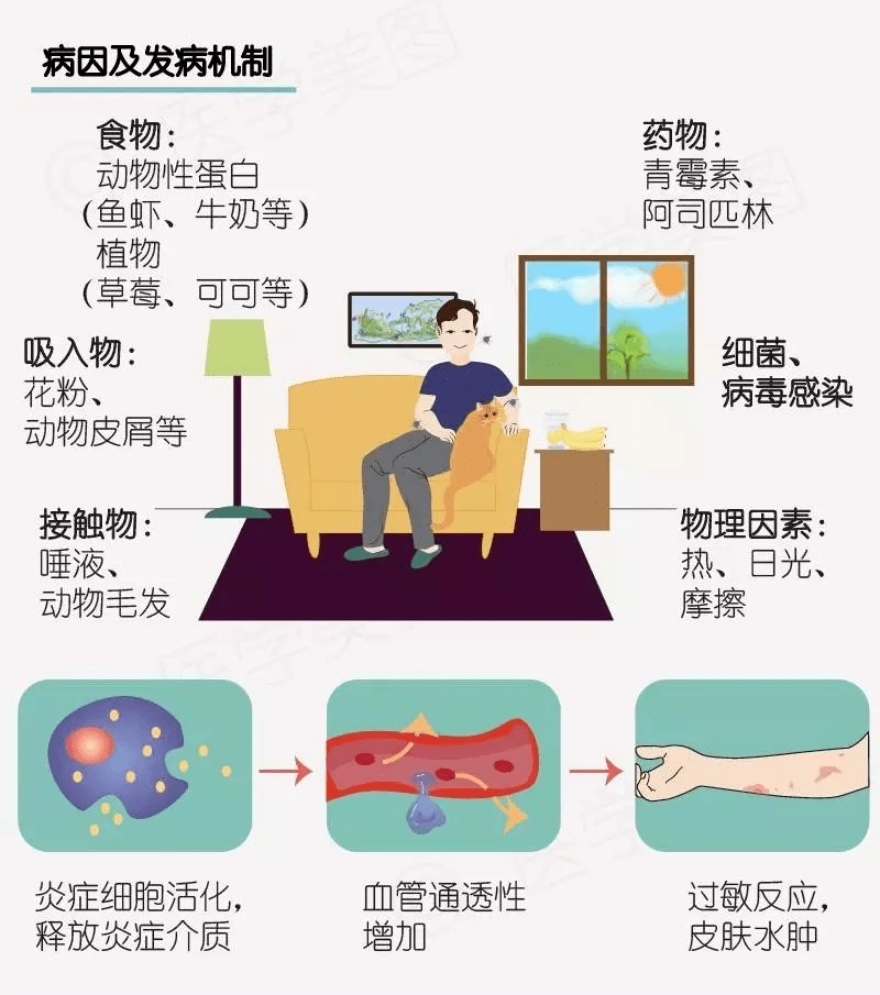 春季高發蕁麻疹溼疹帶狀皰疹高發這份預防指南請查收