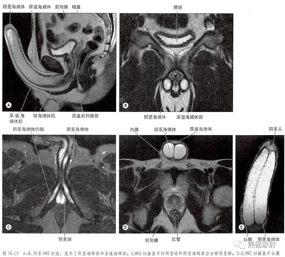 腺mri封套筋膜男性肛提肌裂隙的冠状面男性尿道前列腺部男性尿道的