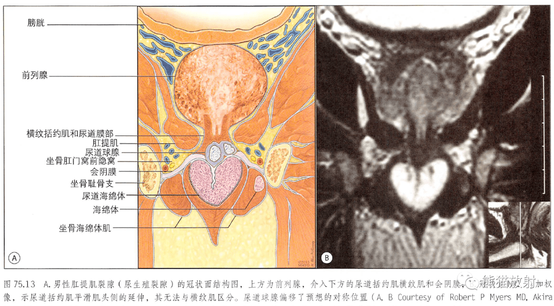 解剖丨膀胱前列腺尿道生殖系統