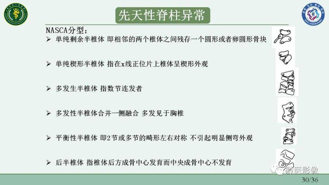 胎兒脊柱異常的多模態成像評估