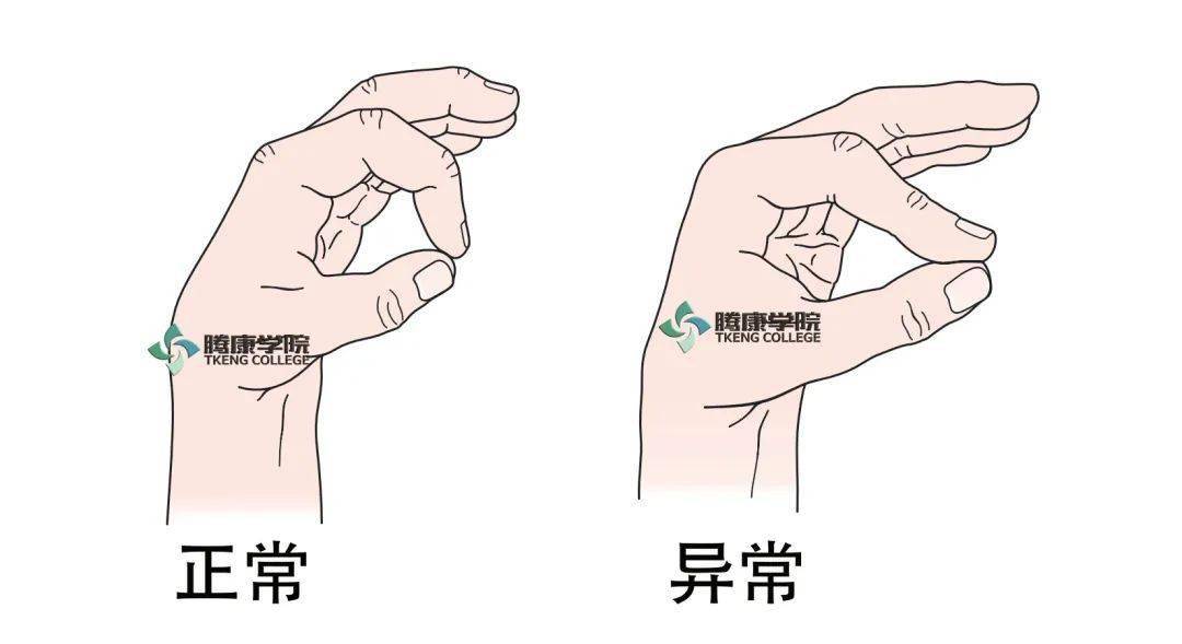 正中神经应用解剖_上臂_损伤_前臂