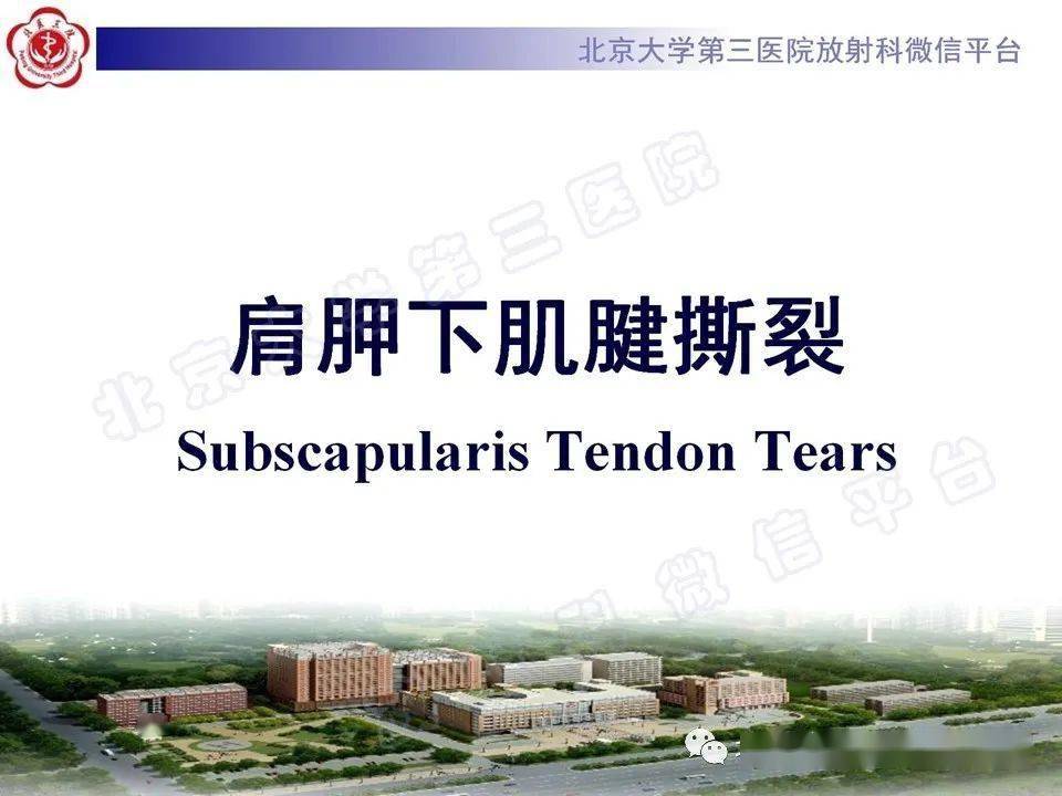 肩胛下肌腱撕裂67影像诊断