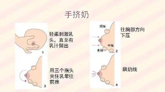 急性乳腺炎排奶手法图片
