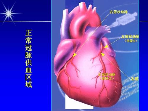 心脏造影报告单图片图片