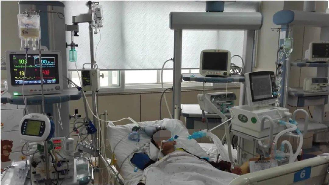 儿童重症监护系列之picu那些事一