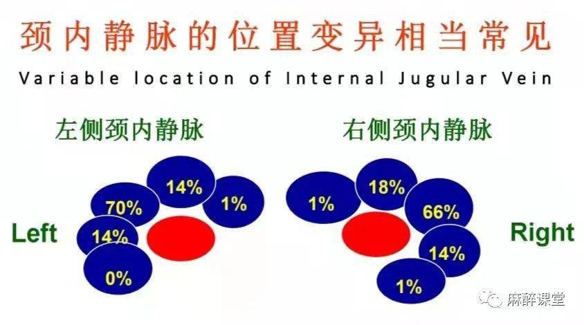 麻醉技术超声引导下深静脉穿刺置管术