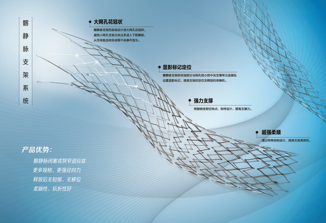 喜讯天鸿盛捷首个国产髂静脉支架系统获nmpa批准上市