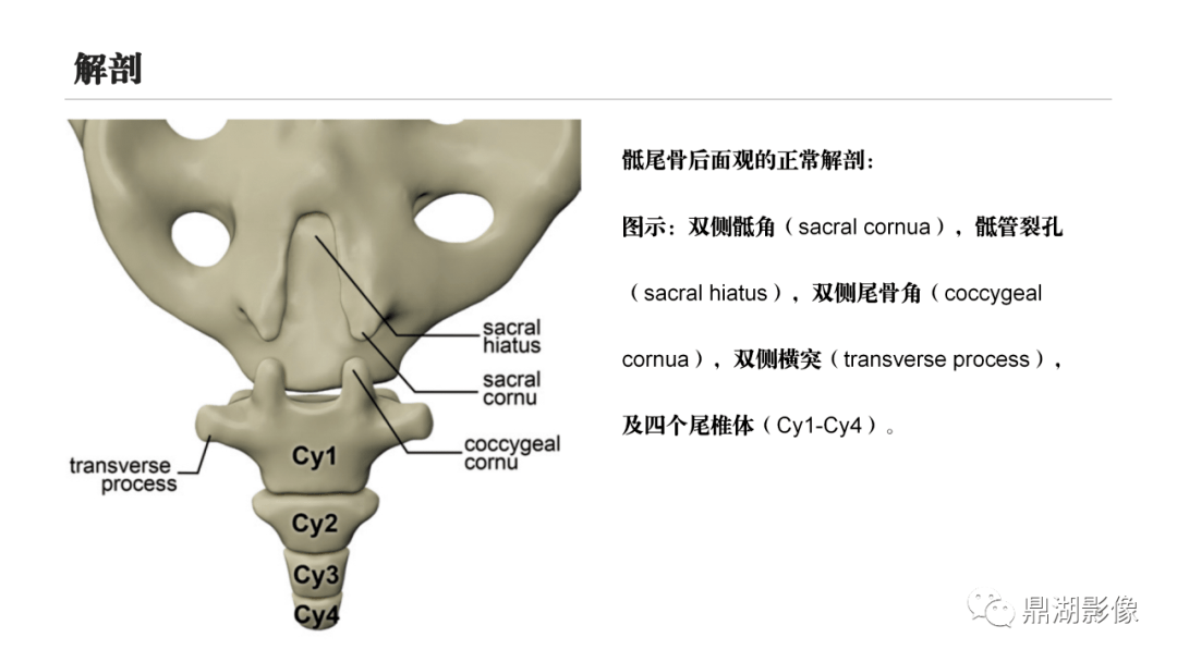 骶尾骨x线解剖图片