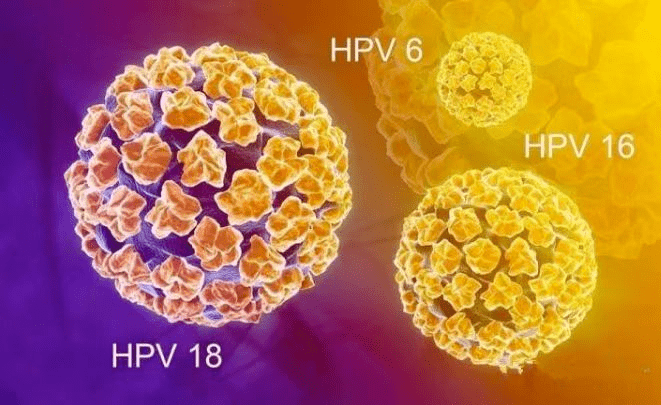 人乳頭瘤病毒(hpv)是一種能引起人類皮膚黏膜增生性病變的微生物,高危