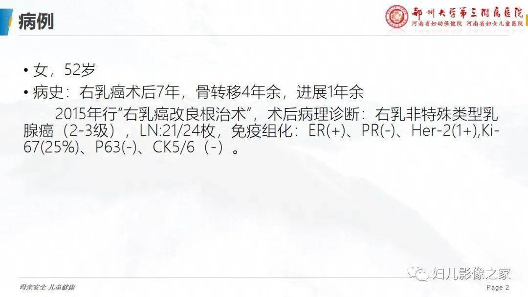 乳腺癌骨转移假性进展您了解吗