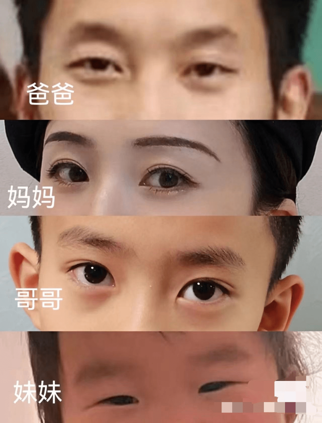 基因_双眼皮_遗传